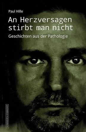 Hille, An Herzversagen stirbt man nicht.